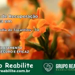 Clínica de Recuperação Católica em Maurilândia do Tocantins | Internação 24h