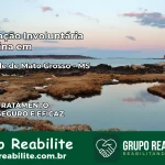 Internação Involuntária Feminina em Rio Verde de Mato Grosso: Salve a Vida de Quem Você Ama